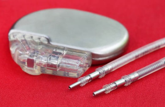 Pacemaker Implant by OrangeCountySurgeons.org  (2)